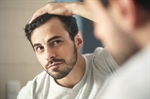 Do Hair Transplants Work for Androgenetic Alopecia? Understanding FUE and Other Methods