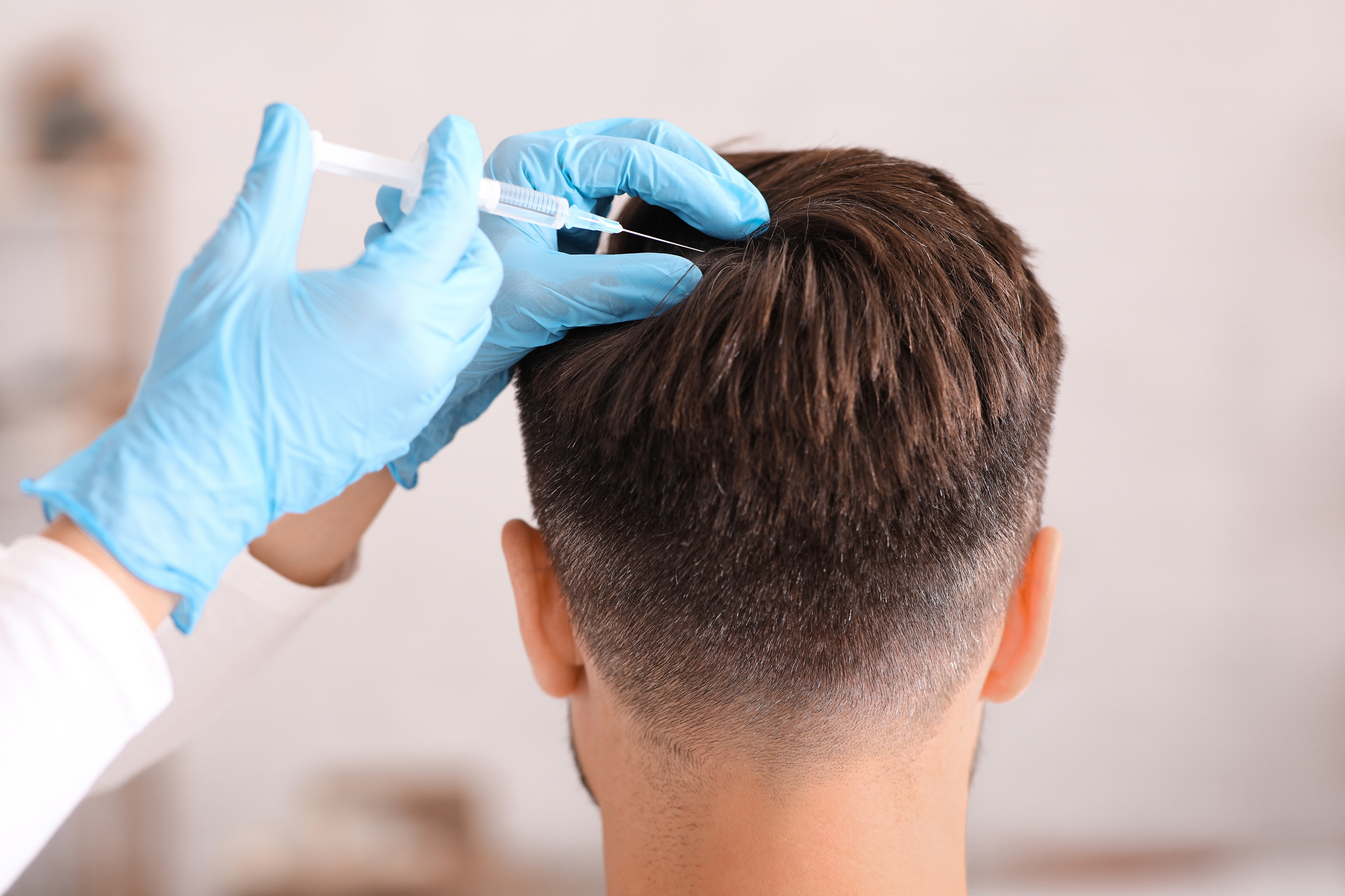 PRP Hair Restoration