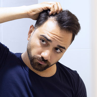 Men’s Hair Loss 